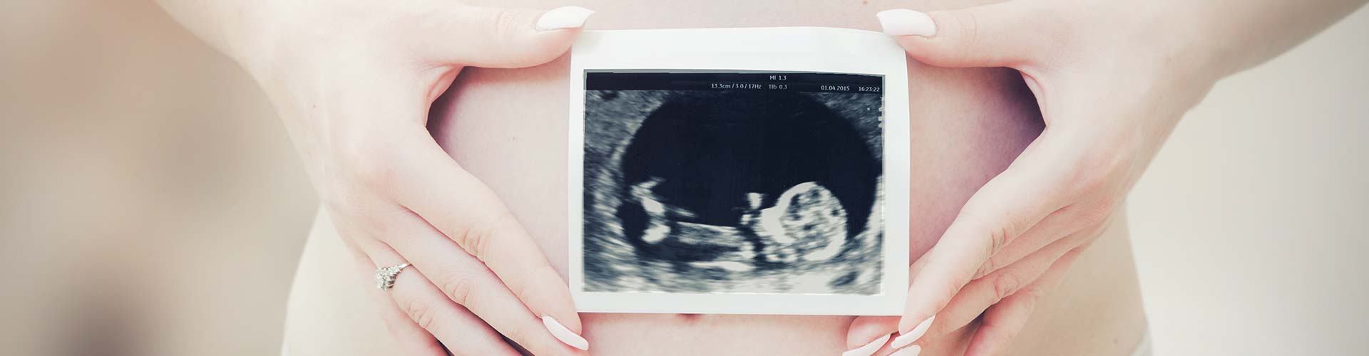 Woman holding ultrasound scan of her baby.